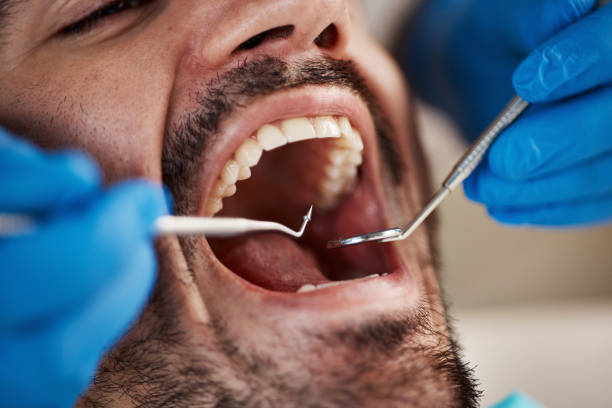 Best Cosmetic Emergency Dentistry in Kensington Park, FL