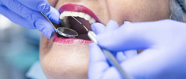 Best Emergency Tooth Extraction in Kensington Park, FL